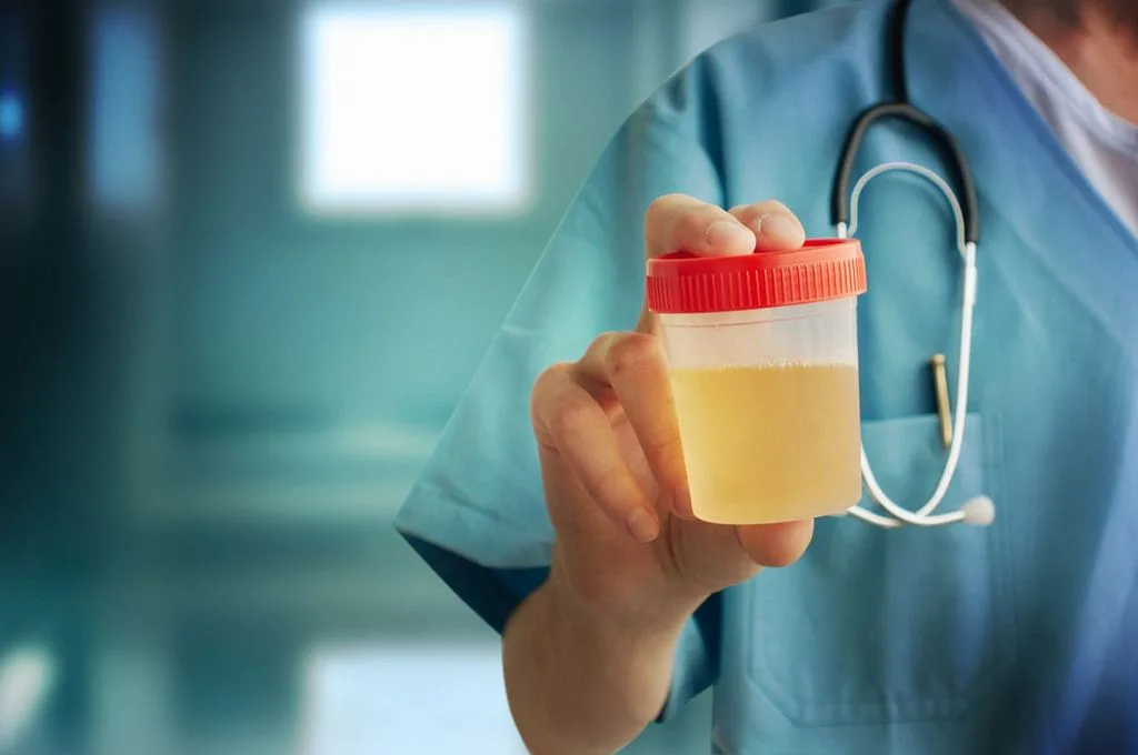 رائحة البول الكريهة عند الرجال: الأسباب، الأعراض، وطرق العلاج